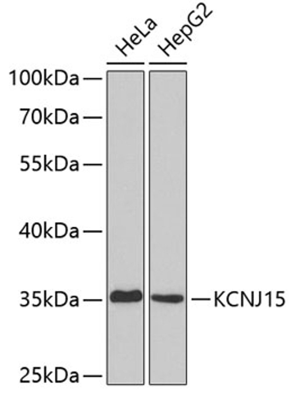 Western blot analysis of extracts of various cell lines, using KCNJ15 antibody (19-220) .<br/>Secondary antibody: HRP Goat Anti-Rabbit IgG (H+L) at 1:10000 dilution.<br/>Lysates/proteins: 25ug per lane.<br/>Blocking buffer: 3% nonfat dry milk in TBST.
