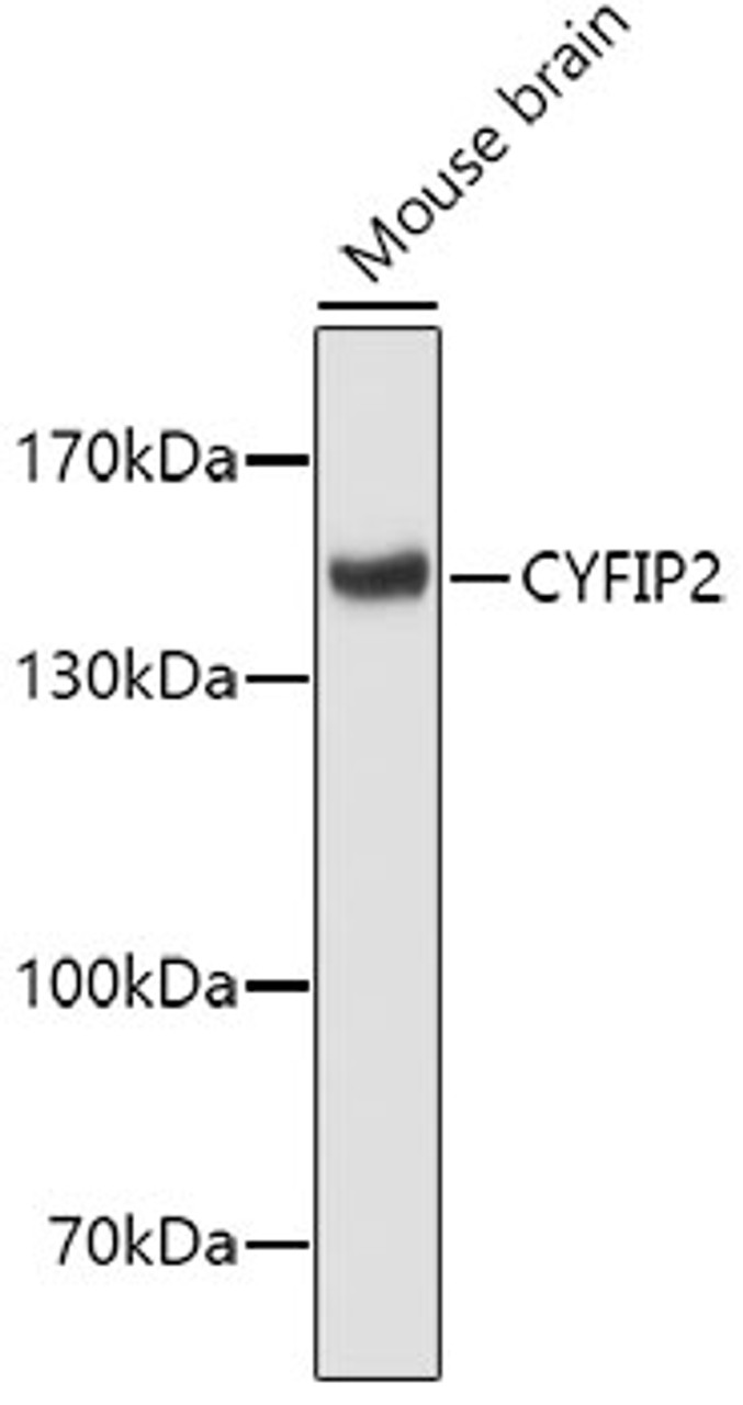 Western blot analysis of extracts of mouse brain, using CYFIP2 antibody (19-431) .<br/>Secondary antibody: HRP Goat Anti-Rabbit IgG (H+L) at 1:10000 dilution.<br/>Lysates/proteins: 25ug per lane.<br/>Blocking buffer: 3% nonfat dry milk in TBST.