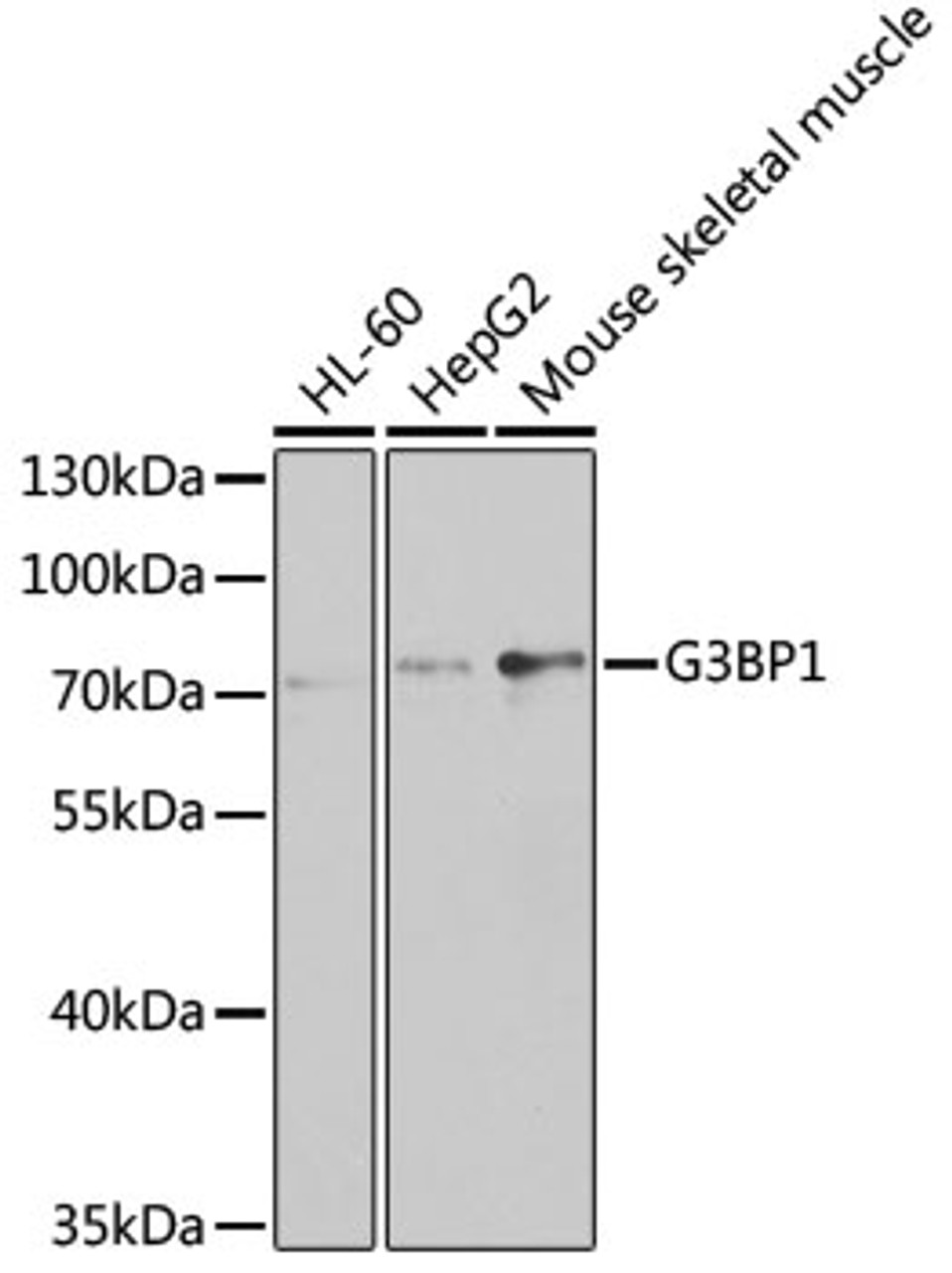 Western blot analysis of extracts of various cell lines, using G3BP1 antibody (19-602) at 1:1000 dilution.<br/>Secondary antibody: HRP Goat Anti-Rabbit IgG (H+L) at 1:10000 dilution.<br/>Lysates/proteins: 25ug per lane.<br/>Blocking buffer: 3% nonfat dry milk in TBST.<br/>Detection: ECL Basic Kit.