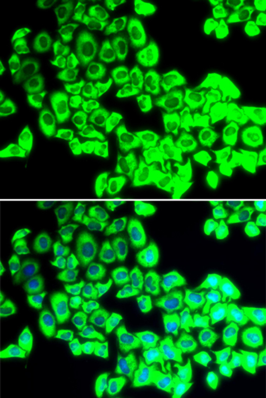 Immunofluorescence analysis of U2OS cells using G3BP1 antibody (19-602) . Blue: DAPI for nuclear staining.
