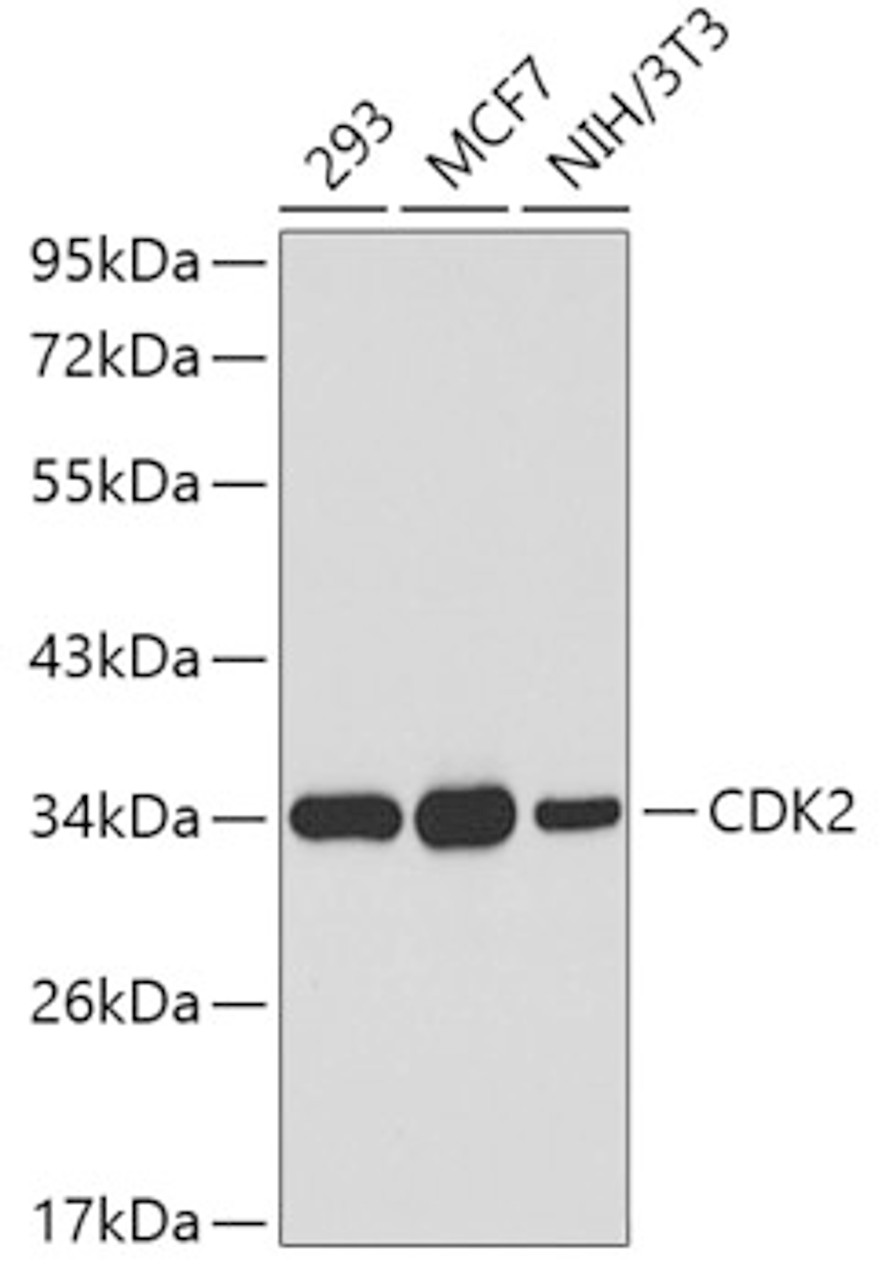 Western blot analysis of extracts of various cell lines, using CDK2 antibody (19-709) .<br/>Secondary antibody: HRP Goat Anti-Rabbit IgG (H+L) at 1:10000 dilution.<br/>Lysates/proteins: 25ug per lane.<br/>Blocking buffer: 3% nonfat dry milk in TBST.