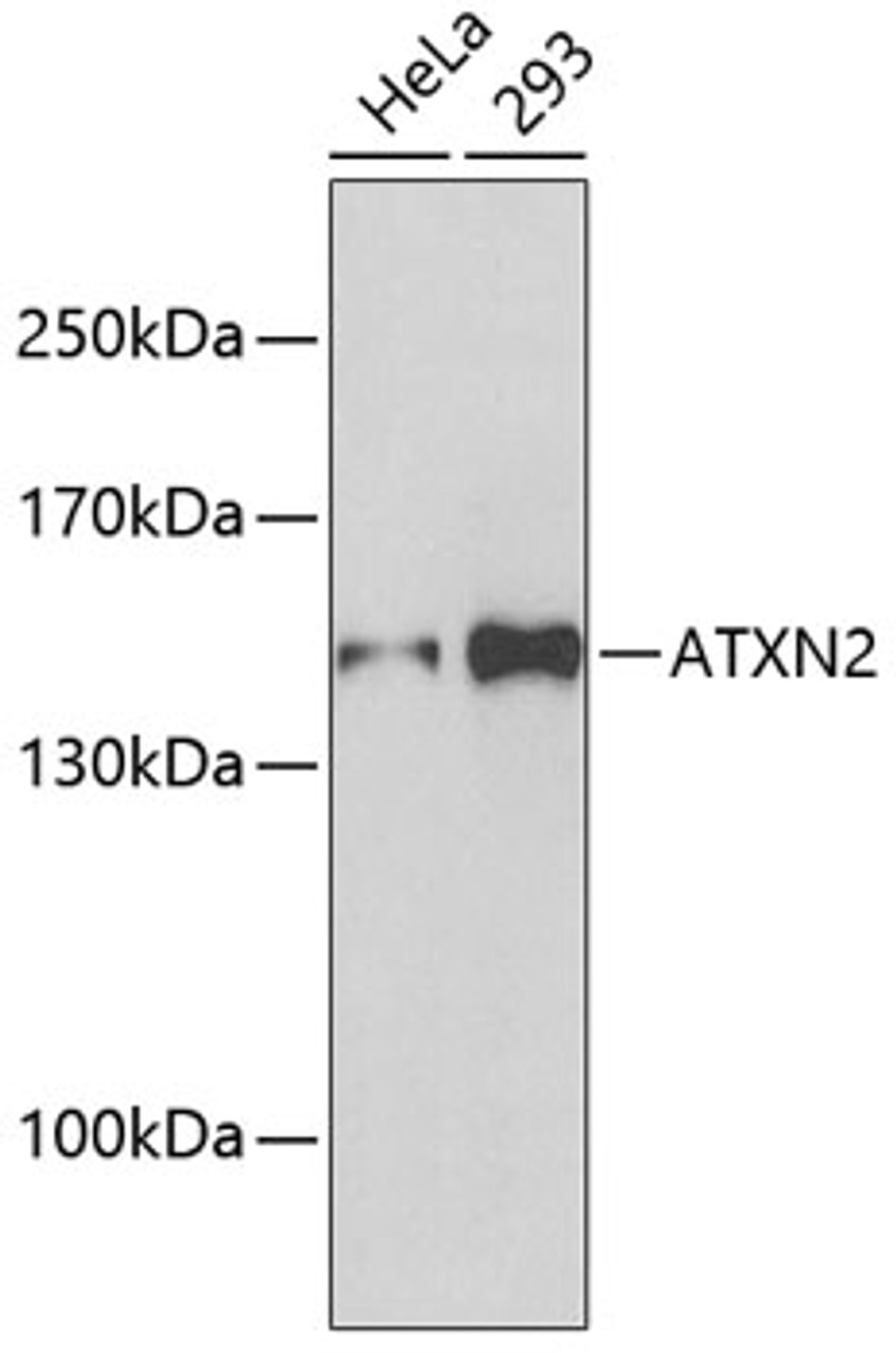 Western blot analysis of extracts of various cell lines, using ATXN2 antibody (19-934) .<br/>Secondary antibody: HRP Goat Anti-Rabbit IgG (H+L) at 1:10000 dilution.<br/>Lysates/proteins: 25ug per lane.<br/>Blocking buffer: 3% nonfat dry milk in TBST.