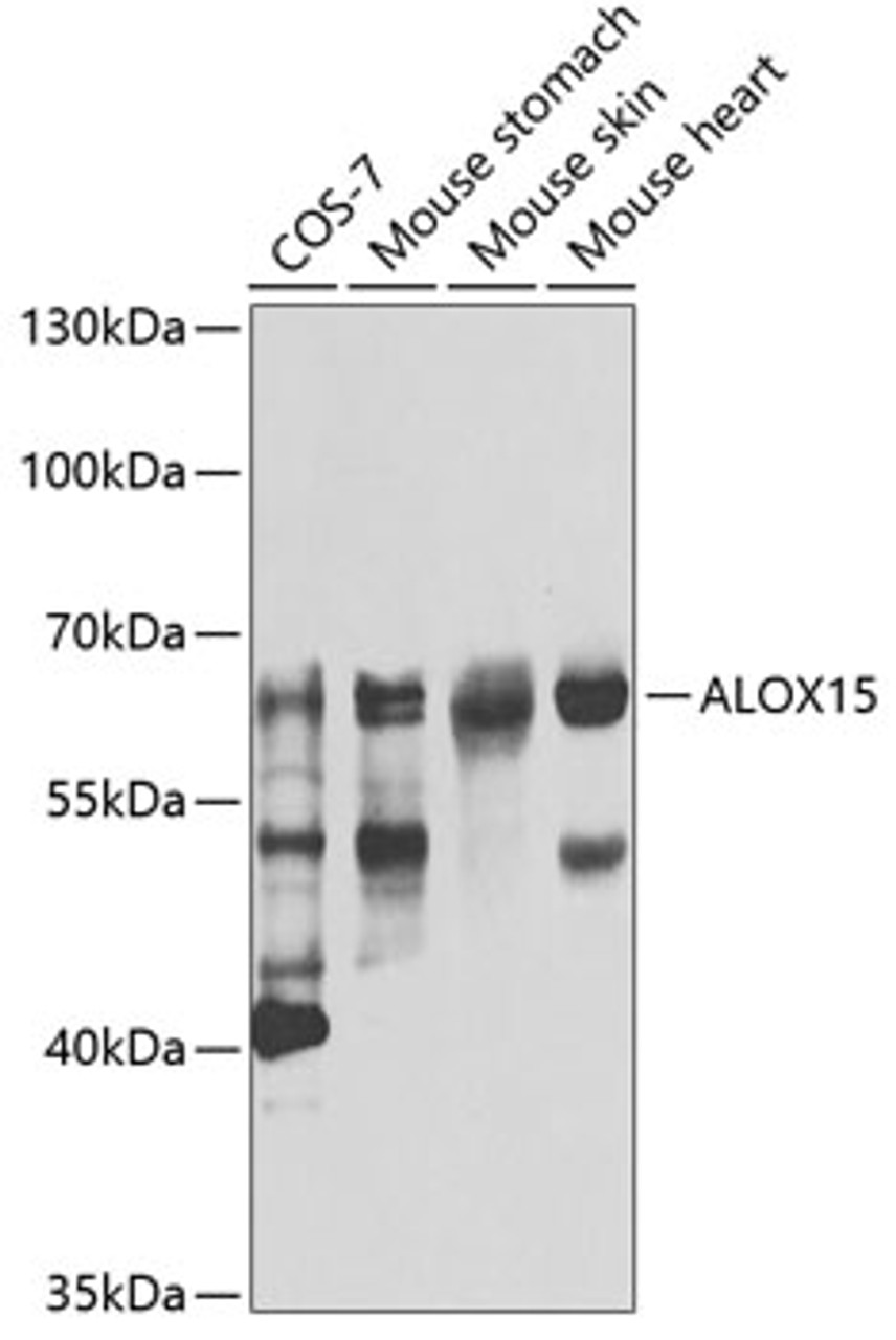 Western blot analysis of extracts of various cell lines, using ALOX15 antibody (22-513) at 1:1000 dilution.<br/>Secondary antibody: HRP Goat Anti-Rabbit IgG (H+L) at 1:10000 dilution.<br/>Lysates/proteins: 25ug per lane.<br/>Blocking buffer: 3% nonfat dry milk in TBST.