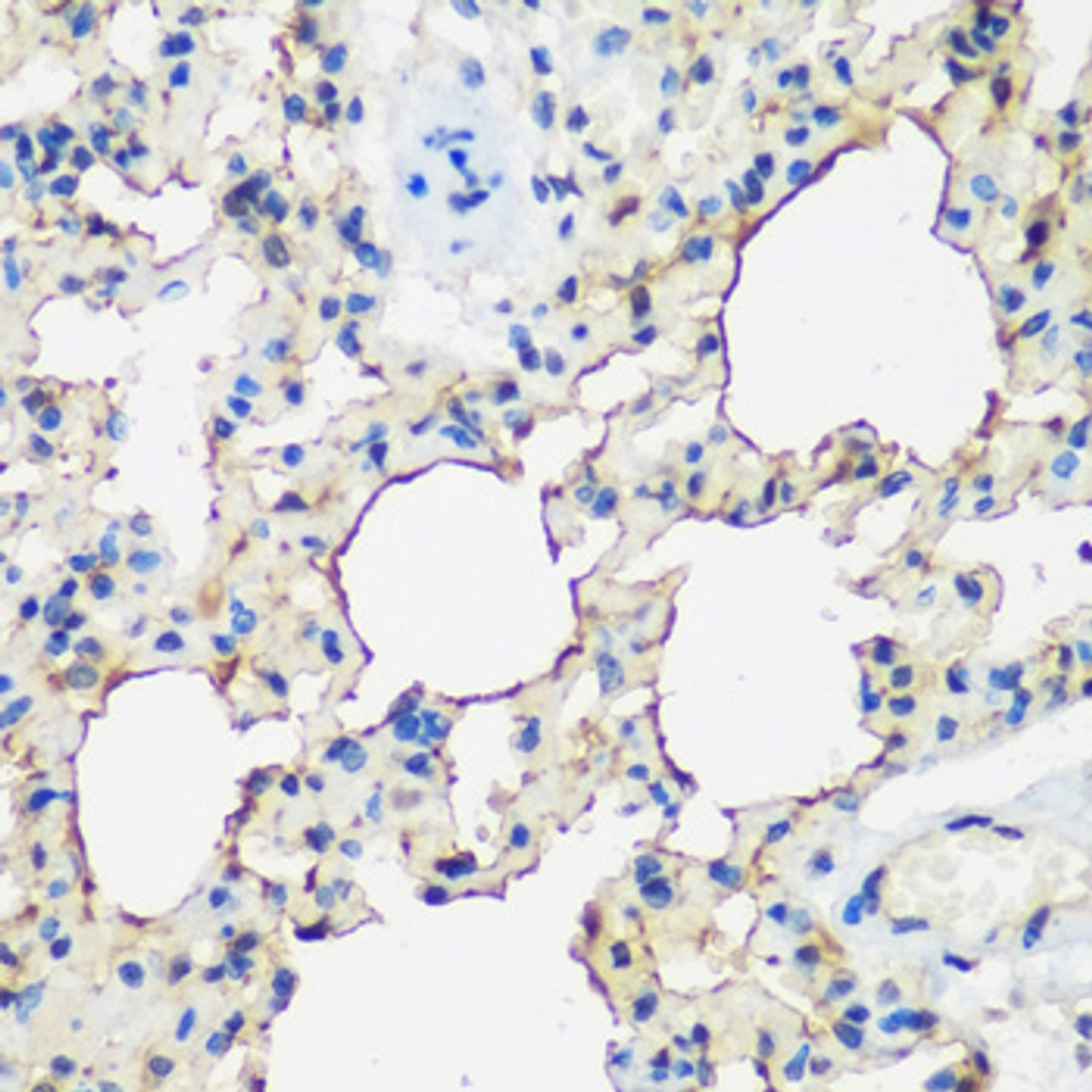 Immunohistochemistry of paraffin-embedded rat lung using ALOX15 antibody (22-513) at dilution of 1:200 (40x lens) .
