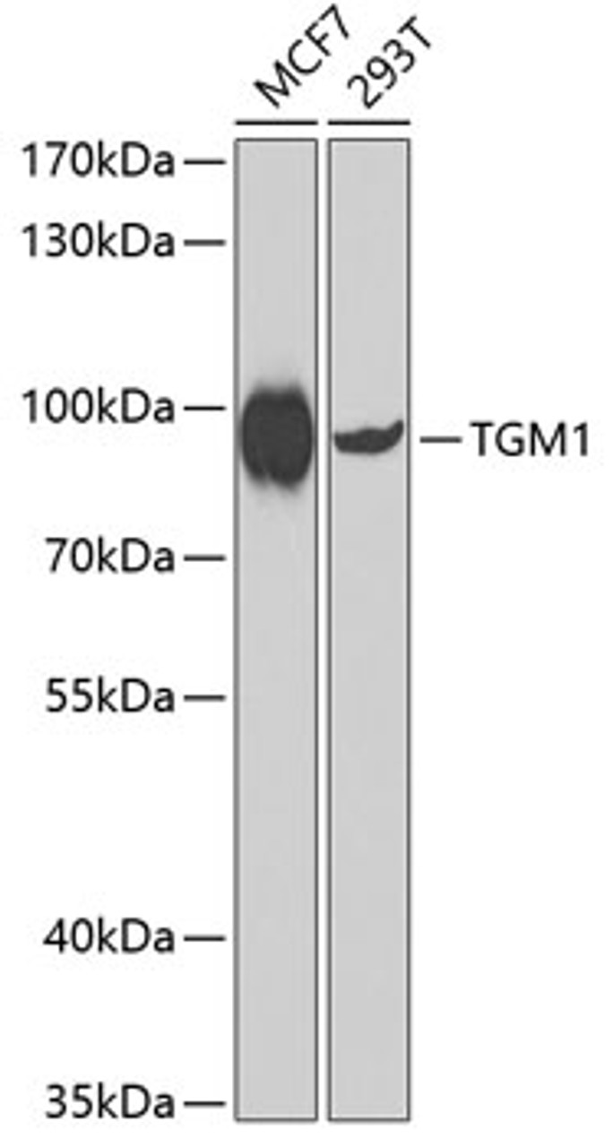 Western blot analysis of extracts of various cell lines, using TGM1 antibody (22-878) at 1:1000 dilution._Secondary antibody: HRP Goat Anti-Rabbit IgG (H+L) at 1:10000 dilution._Lysates/proteins: 25ug per lane._Blocking buffer: 3% nonfat dry milk in TBST._Detection: ECL Enhanced Kit._Exposure time: 90s.