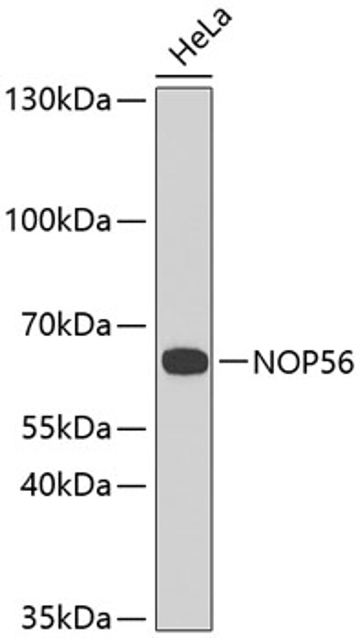Western blot analysis of extracts of HeLa cells, using NOP56 antibody (23-363) .<br/>Secondary antibody: HRP Goat Anti-Rabbit IgG (H+L) at 1:10000 dilution.<br/>Lysates/proteins: 25ug per lane.<br/>Blocking buffer: 3% nonfat dry milk in TBST.