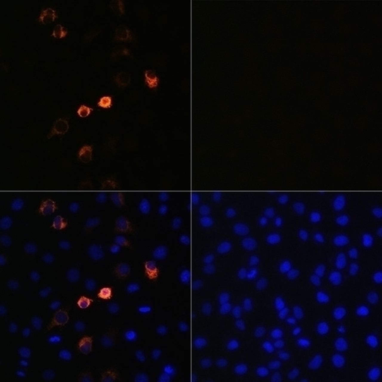 <strong>Figure 1 Immunofluorescence Validation of SARS-CoV-2 (COVID-19) Spike in HeLa cells</strong><br>
Immunofluorescence analysis of HeLa cells, untreated (right) and SARS-CoV-2 (COVID-19) spike plasmid transfected (left) using SARS-CoV-2 (COVID-19) spike antibody, 24-032, at 1:100 dilution. Blue: DAPI for nuclear staining.