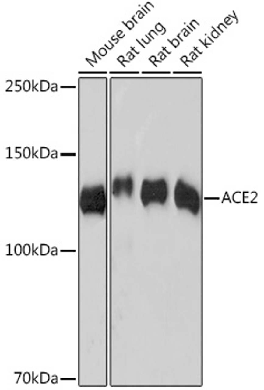 <strong>Figure 1 Western Blot Validation in Mouse and Rat Tissue Lysates</strong><br>
Loading: 25 µg of lysates per lane.
Antibodies: ACE2 antibody, 24-033, at 1:1000 dilution. Secondary: Goat anti-rabbit IgG HRP conjugate at 1:10000 dilution. Blocking buffer: 3% nonfat dry milk in TBST.