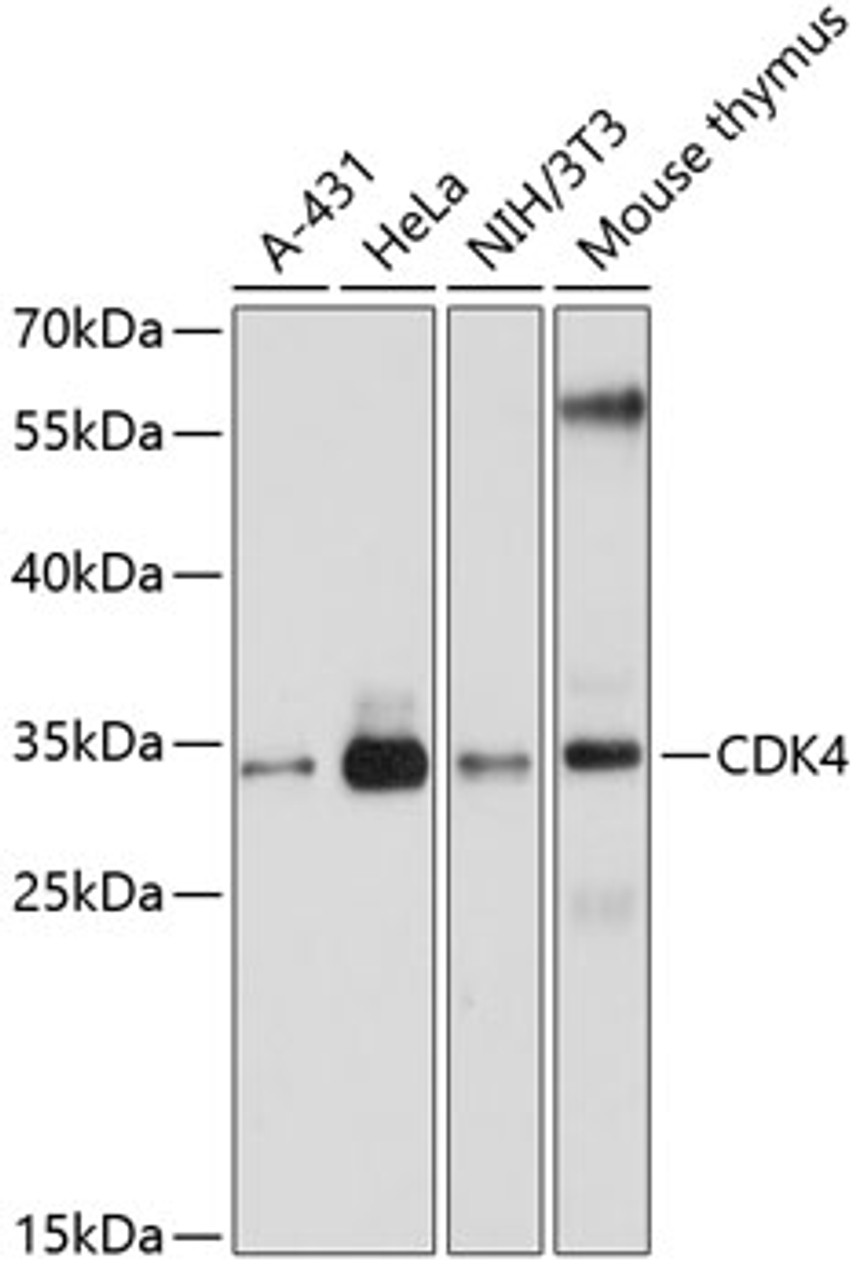 Western blot analysis of extracts of various cell lines, using CDK4 antibody (13-006) at 1:1000 dilution.<br/>Secondary antibody: HRP Goat Anti-Mouse IgG (H+L) (AS003) at 1:10000 dilution.<br/>Lysates/proteins: 25ug per lane.<br/>Blocking buffer: 3% nonfat dry milk in TBST.<br/>Detection: ECL Enhanced Kit.<br/>Exposure time: 5s.