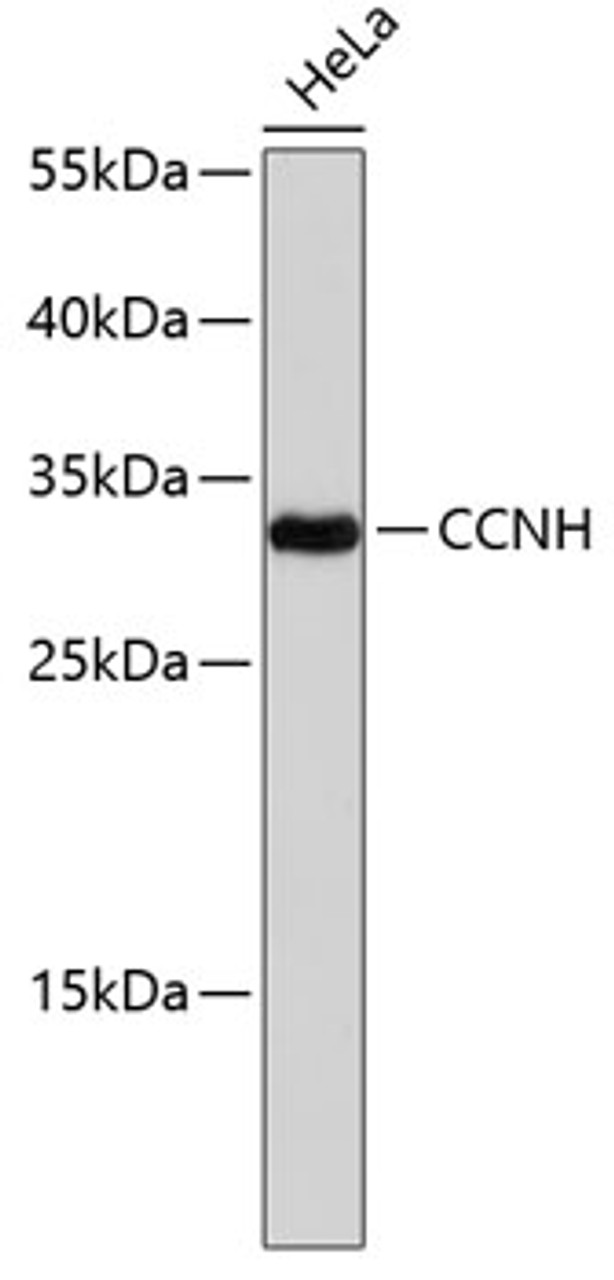 Western blot analysis of extracts of HeLa cells, using CCNH antibody (13-035) .<br/>Secondary antibody: HRP Goat Anti-Rabbit IgG (H+L) at 1:10000 dilution.<br/>Lysates/proteins: 25ug per lane.<br/>Blocking buffer: 3% nonfat dry milk in TBST.