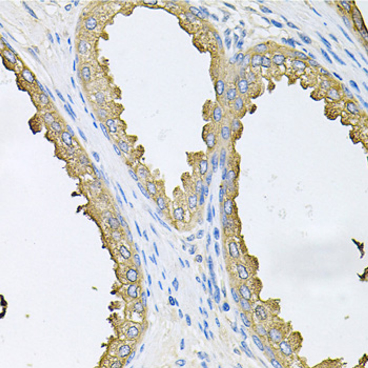Immunohistochemistry of paraffin-embedded human prostate using ABL1 antibody (13-126) at dilution of 1:100 (40x lens) .