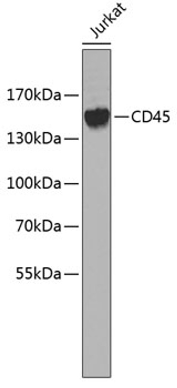 Western blot analysis of extracts of Jurkat cells, using CD45 antibody (13-156) .<br/>Secondary antibody: HRP Goat Anti-Rabbit IgG (H+L) at 1:10000 dilution.<br/>Lysates/proteins: 25ug per lane.<br/>Blocking buffer: 3% nonfat dry milk in TBST.