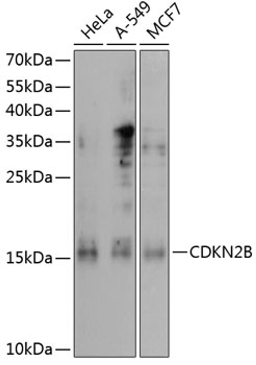 Western blot analysis of extracts of various cell lines, using CDKN2B antibody (13-165) at 1:1000 dilution.<br/>Secondary antibody: HRP Goat Anti-Rabbit IgG (H+L) at 1:10000 dilution.<br/>Lysates/proteins: 25ug per lane.<br/>Blocking buffer: 3% nonfat dry milk in TBST.<br/>Detection: ECL Enhanced Kit.<br/>Exposure time: 90s.