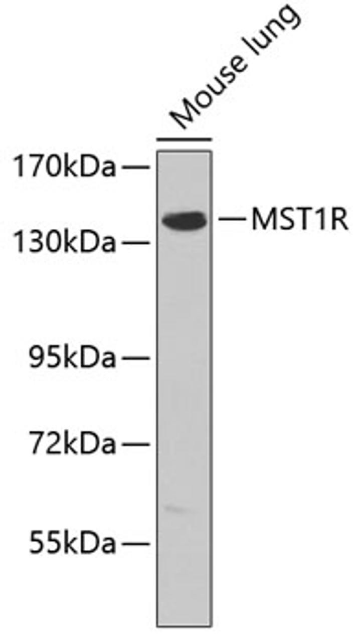 Western blot analysis of extracts of mouse lung, using MST1R antibody (13-211) .<br/>Secondary antibody: HRP Goat Anti-Rabbit IgG (H+L) at 1:10000 dilution.<br/>Lysates/proteins: 25ug per lane.<br/>Blocking buffer: 3% nonfat dry milk in TBST.