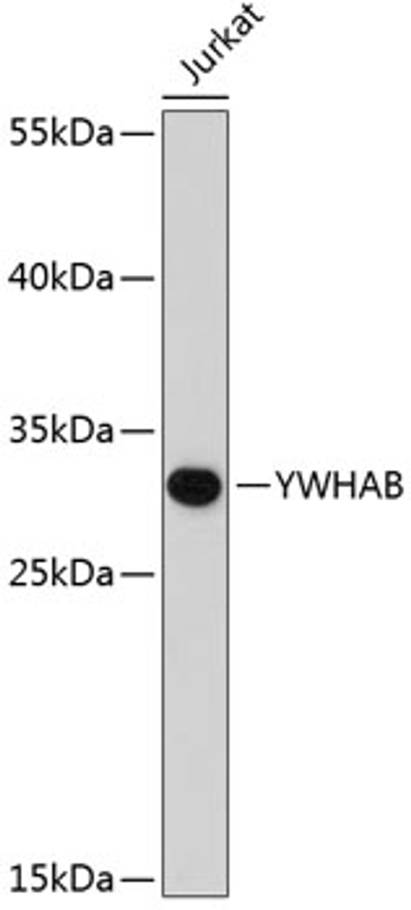 Western blot analysis of extracts of Jurkat cells, using YWHAB antibody (13-216) .<br/>Secondary antibody: HRP Goat Anti-Rabbit IgG (H+L) at 1:10000 dilution.<br/>Lysates/proteins: 25ug per lane.<br/>Blocking buffer: 3% nonfat dry milk in TBST.
