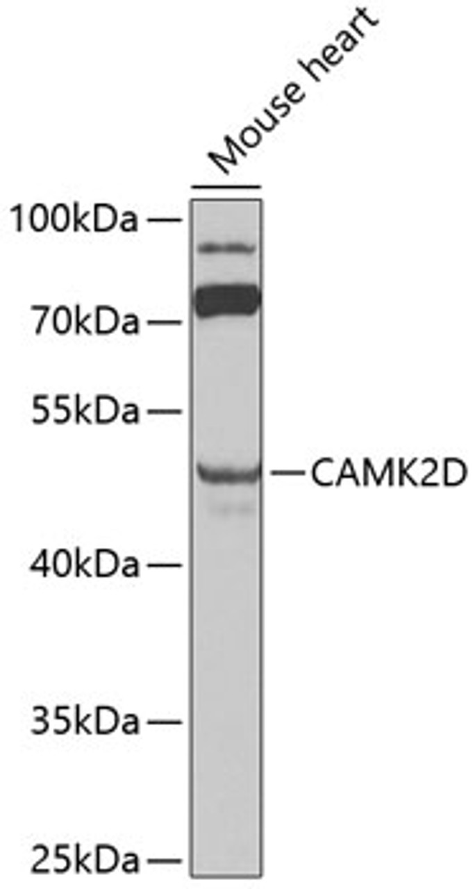 Western blot analysis of extracts of mouse heart, using CAMK2D antibody (13-237) at 1:1000 dilution._Secondary antibody: HRP Goat Anti-Rabbit IgG (H+L) at 1:10000 dilution._Lysates/proteins: 25ug per lane._Blocking buffer: 3% nonfat dry milk in TBST._Detection: ECL Enhanced Kit._Exposure time: 90s.