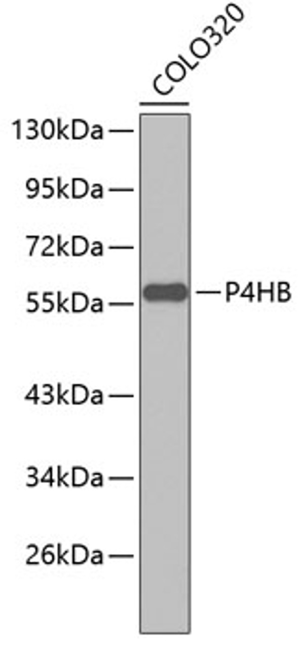 Western blot analysis of extracts of COLO320 cells, using P4HB antibody (13-261) .<br/>Secondary antibody: HRP Goat Anti-Rabbit IgG (H+L) at 1:10000 dilution.<br/>Lysates/proteins: 25ug per lane.<br/>Blocking buffer: 3% nonfat dry milk in TBST.