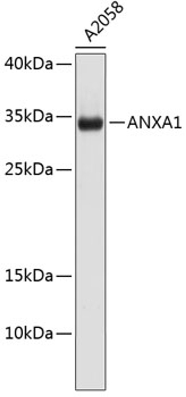 Western blot analysis of extracts of A2058 cells, using ANXA1 antibody (13-279) .<br/>Secondary antibody: HRP Goat Anti-Rabbit IgG (H+L) at 1:10000 dilution.<br/>Lysates/proteins: 25ug per lane.<br/>Blocking buffer: 3% nonfat dry milk in TBST.