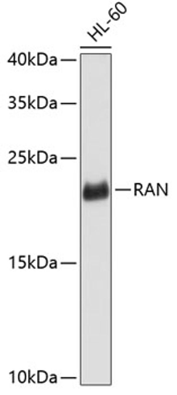 Western blot analysis of extracts of HL-60 cells, using RAN antibody (13-288) .<br/>Secondary antibody: HRP Goat Anti-Rabbit IgG (H+L) at 1:10000 dilution.<br/>Lysates/proteins: 25ug per lane.<br/>Blocking buffer: 3% nonfat dry milk in TBST.