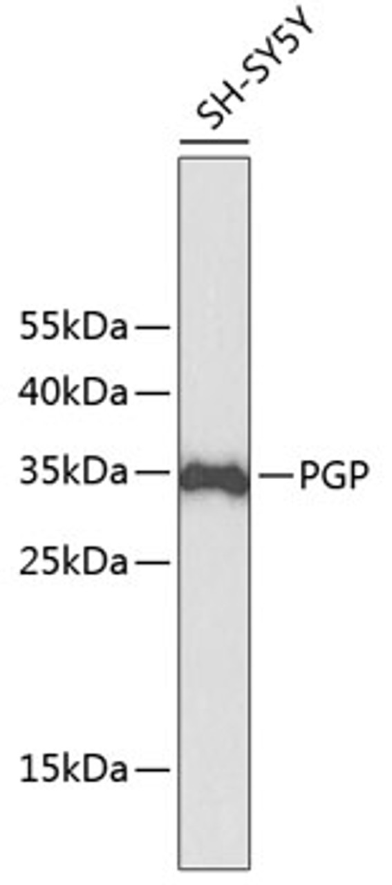 Western blot analysis of extracts of SH-SY5Y cells, using PGP antibody (13-366) .<br/>Secondary antibody: HRP Goat Anti-Rabbit IgG (H+L) at 1:10000 dilution.<br/>Lysates/proteins: 25ug per lane.<br/>Blocking buffer: 3% nonfat dry milk in TBST.