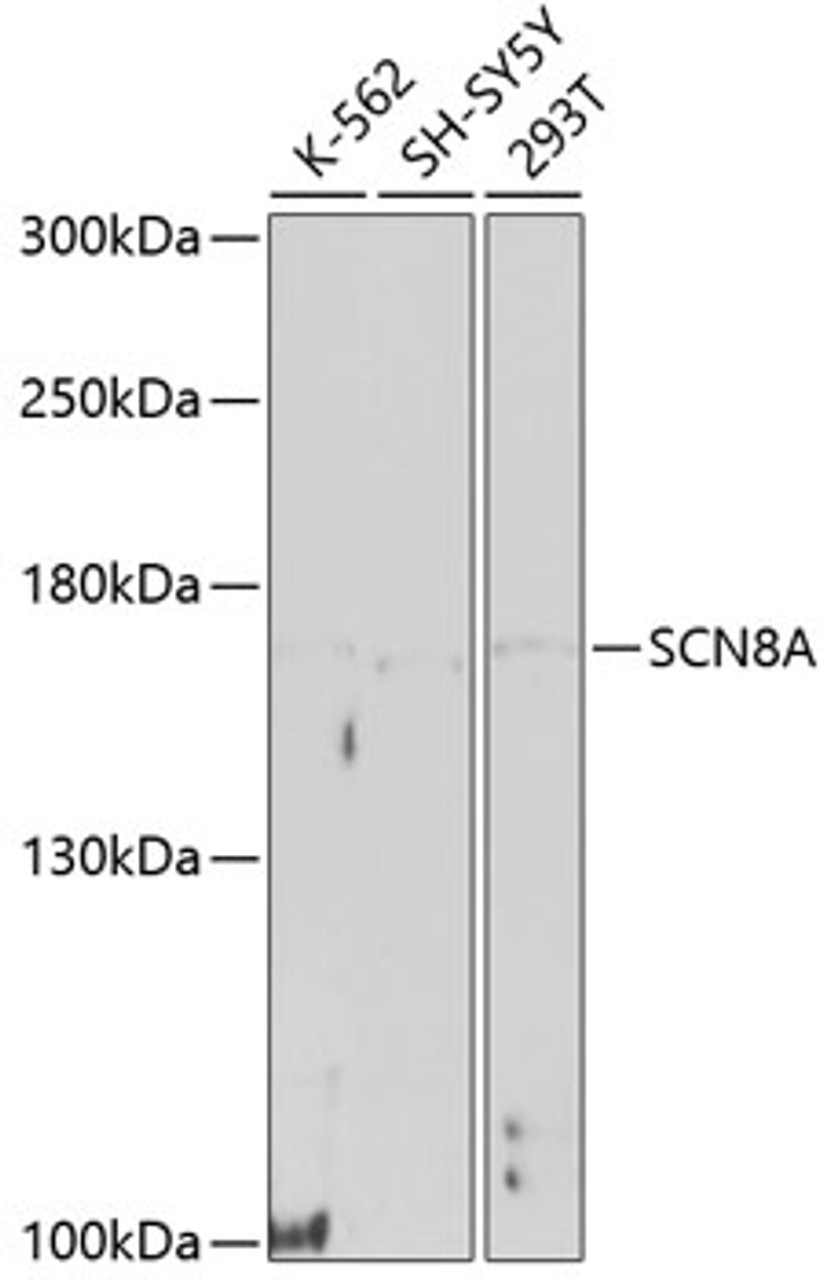 Western blot analysis of extracts of various cell lines, using SCN8A antibody (13-368) at 1:1000 dilution.<br/>Secondary antibody: HRP Goat Anti-Rabbit IgG (H+L) at 1:10000 dilution.<br/>Lysates/proteins: 25ug per lane.<br/>Blocking buffer: 3% nonfat dry milk in TBST.<br/>Detection: ECL Basic Kit.<br/>Exposure time: 90s.