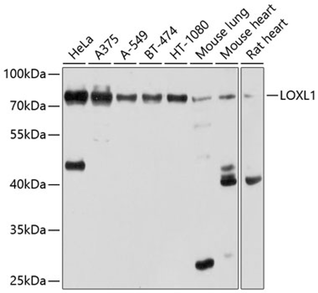 Western blot analysis of extracts of various cell lines, using LOXL1 antibody (13-489) at 1:1000 dilution.<br/>Secondary antibody: HRP Goat Anti-Rabbit IgG (H+L) at 1:10000 dilution.<br/>Lysates/proteins: 25ug per lane.<br/>Blocking buffer: 3% nonfat dry milk in TBST.<br/>Detection: ECL Basic Kit.<br/>Exposure time: 5s.