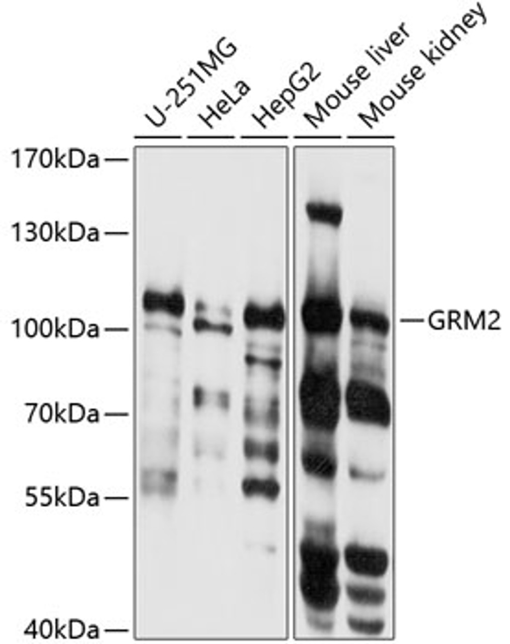 Western blot analysis of extracts of various cell lines, using GRM2 antibody (13-724) at 1:1000 dilution.<br/>Secondary antibody: HRP Goat Anti-Rabbit IgG (H+L) at 1:10000 dilution.<br/>Lysates/proteins: 25ug per lane.<br/>Blocking buffer: 3% nonfat dry milk in TBST.<br/>Detection: ECL Basic Kit.<br/>Exposure time: 1s.