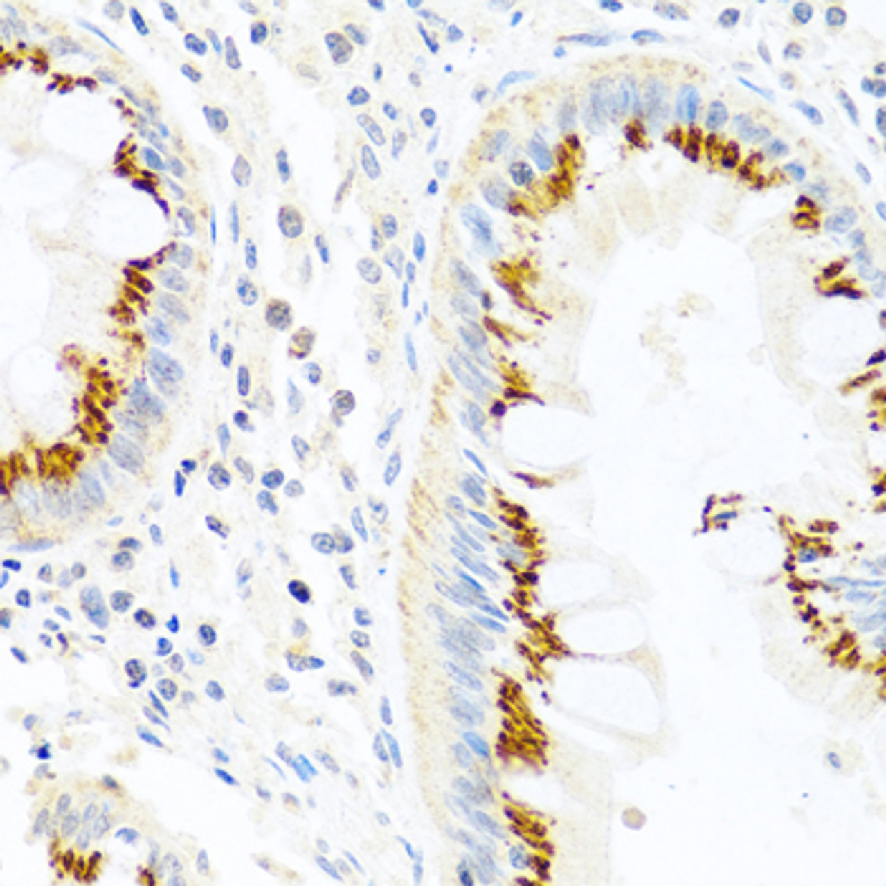 Immunohistochemistry of paraffin-embedded human colon using FAM3B antibody (13-815) at dilution of 1:100 (40x lens) .
