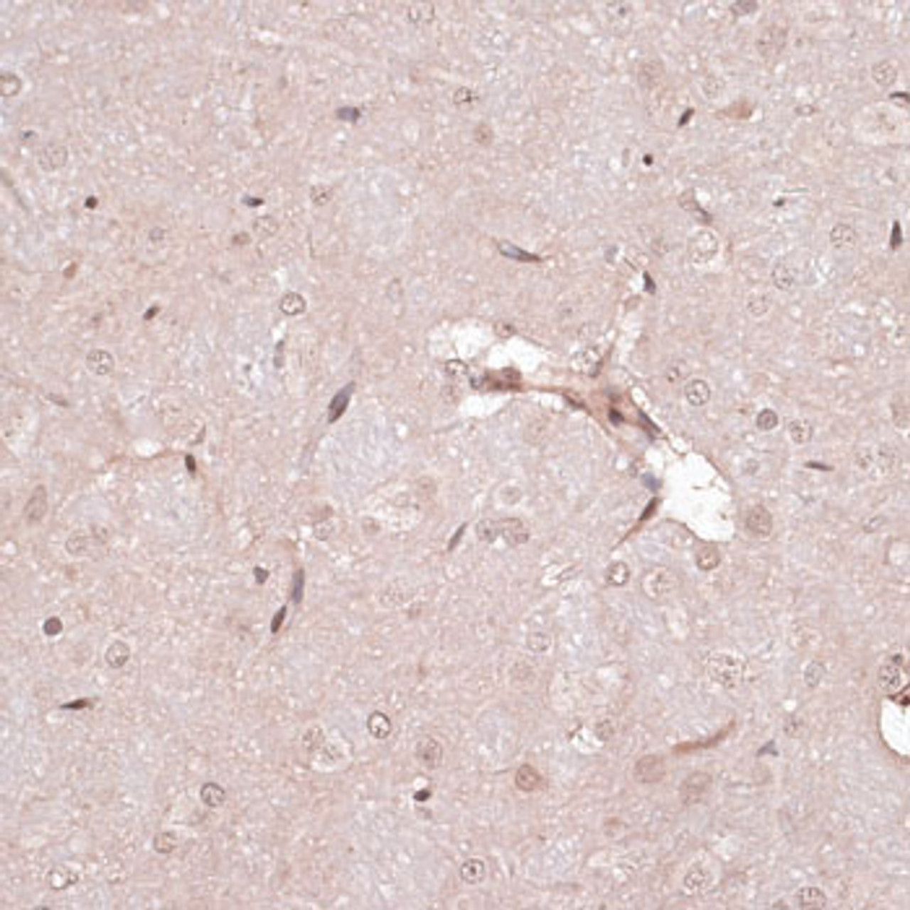 Immunohistochemistry of paraffin-embedded rat brain using CREB1 antibody (13-900) at dilution of 1:100 (40x lens) .