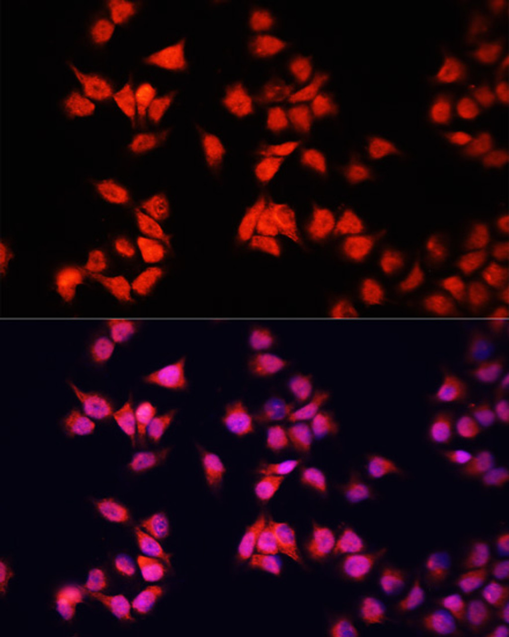 Immunofluorescence analysis of HeLa cells using BRCA1 antibody (13-982) at dilution of 1:100. Blue: DAPI for nuclear staining.