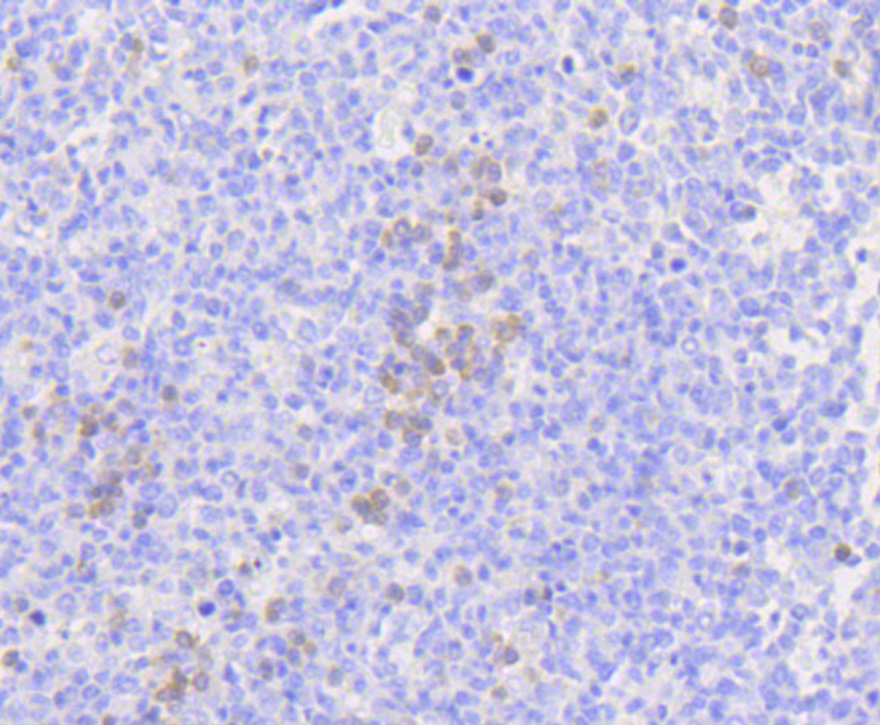 Immunohistochemistry of paraffin-embedded human tonsil using MLKL antibody (14-026) at dilution of 1:100 (40x lens) .