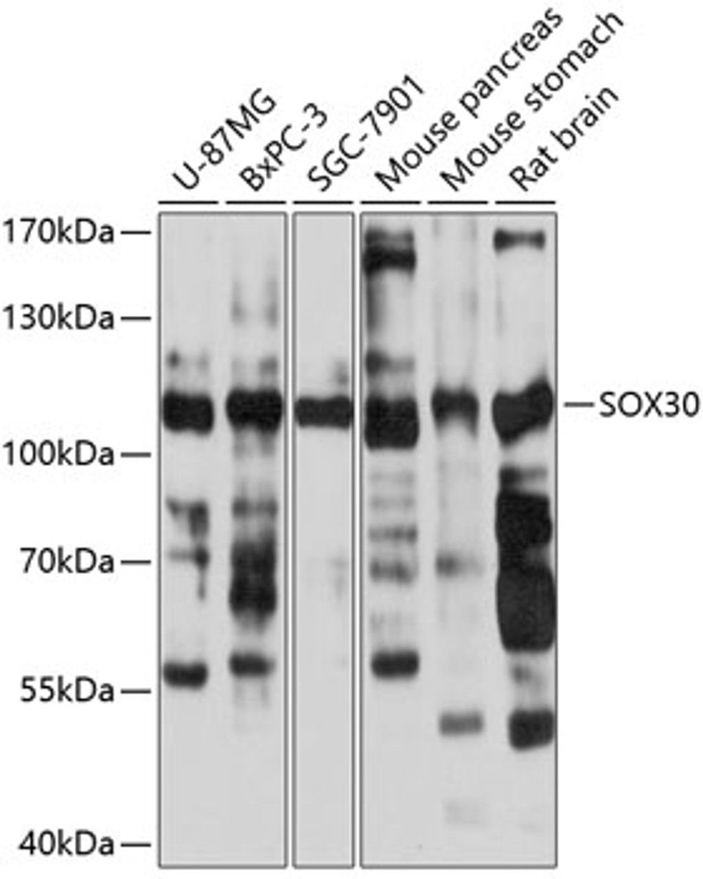 Western blot analysis of extracts of various cell lines, using SOX30 antibody (14-134) at 1:1000 dilution.<br/>Secondary antibody: HRP Goat Anti-Rabbit IgG (H+L) at 1:10000 dilution.<br/>Lysates/proteins: 25ug per lane.<br/>Blocking buffer: 3% nonfat dry milk in TBST.<br/>Detection: ECL Basic Kit.<br/>Exposure time: 3s.