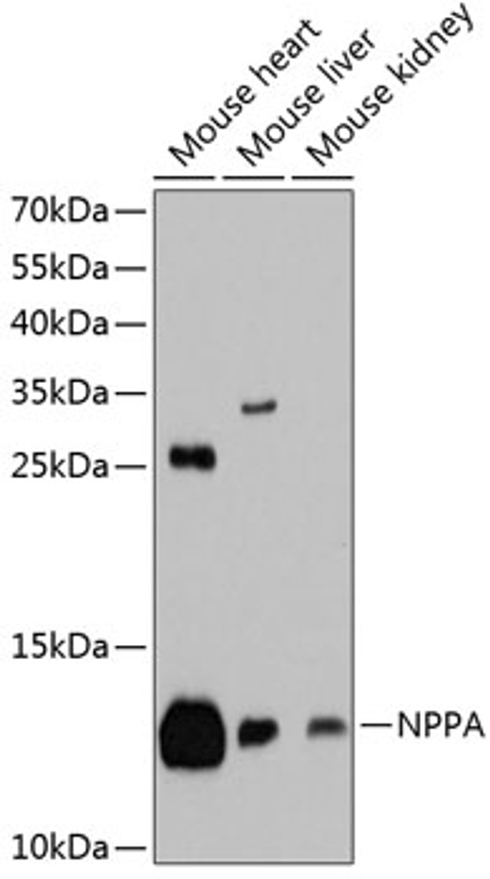 Western blot analysis of extracts of various cell lines, using NPPA antibody (14-171) at 1:1000 dilution.<br/>Secondary antibody: HRP Goat Anti-Rabbit IgG (H+L) at 1:10000 dilution.<br/>Lysates/proteins: 25ug per lane.<br/>Blocking buffer: 3% nonfat dry milk in TBST.<br/>Detection: ECL Basic Kit.<br/>Exposure time: 90s.