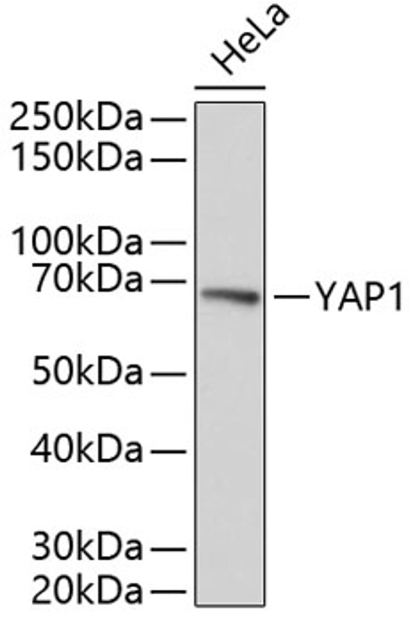 Western blot analysis of extracts of HeLa cells, using YAP1 antibody (14-188) .<br/>Secondary antibody: HRP Goat Anti-Rabbit IgG (H+L) at 1:10000 dilution.<br/>Lysates/proteins: 25ug per lane.<br/>Blocking buffer: 3% nonfat dry milk in TBST.