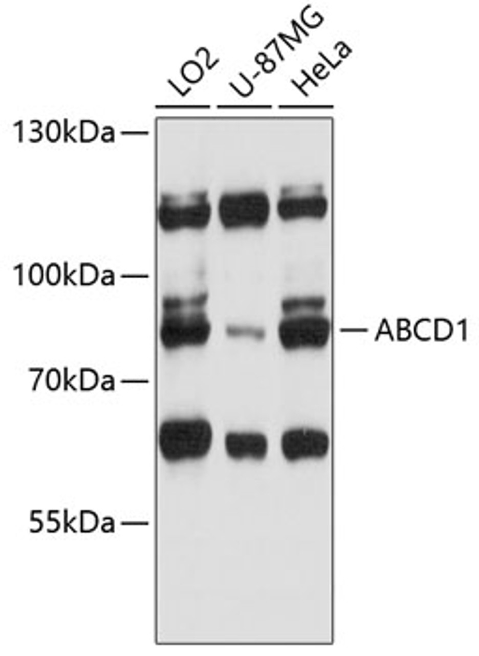 Western blot analysis of extracts of various cell lines, using ABCD1 antibody (14-276) at 1:3000 dilution.<br/>Secondary antibody: HRP Goat Anti-Rabbit IgG (H+L) at 1:10000 dilution.<br/>Lysates/proteins: 25ug per lane.<br/>Blocking buffer: 3% nonfat dry milk in TBST.<br/>Detection: ECL Basic Kit.<br/>Exposure time: 30s.