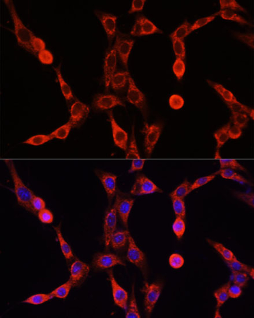 Immunofluorescence analysis of NIH/3T3 cells using ABCD1 antibody (14-276) at dilution of 1:100. Blue: DAPI for nuclear staining.