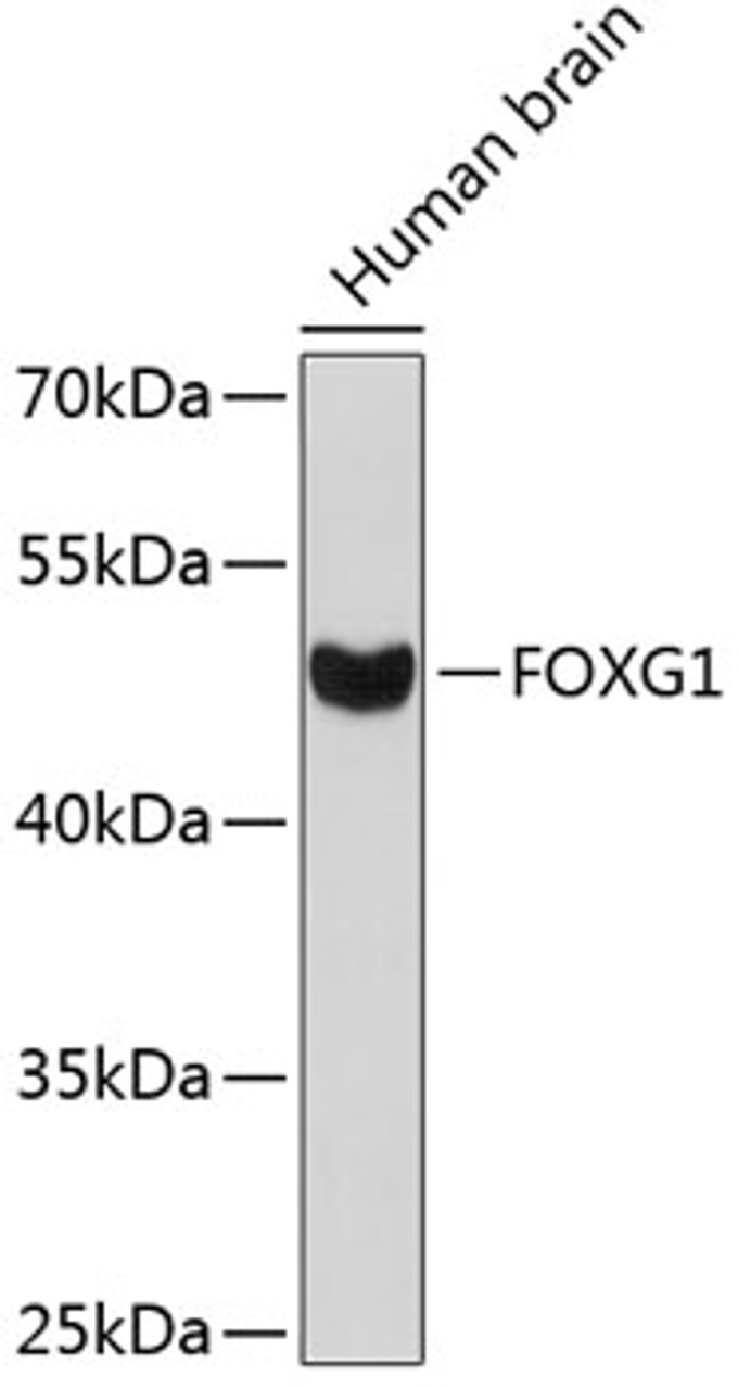 Western blot analysis of extracts of human brain, using FOXG1 antibody (14-393) .<br/>Secondary antibody: HRP Goat Anti-Rabbit IgG (H+L) at 1:10000 dilution.<br/>Lysates/proteins: 25ug per lane.<br/>Blocking buffer: 3% nonfat dry milk in TBST.