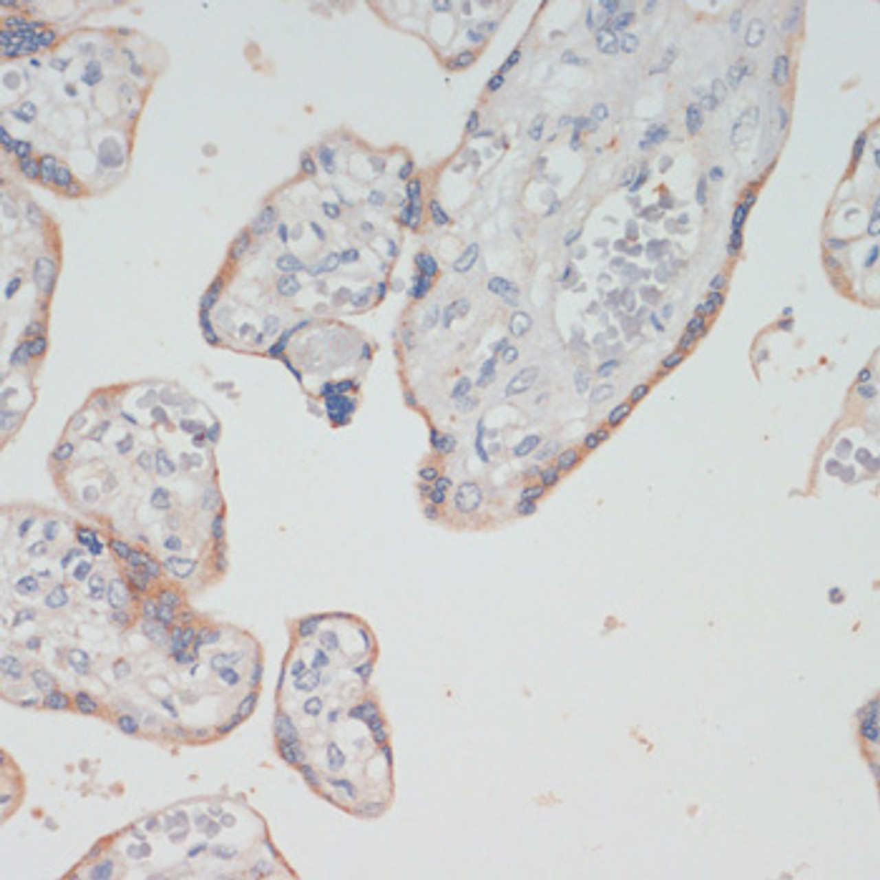 Immunohistochemistry of paraffin-embedded human placenta using CHAT antibody (14-412) at dilution of 1:200 (40x lens) .