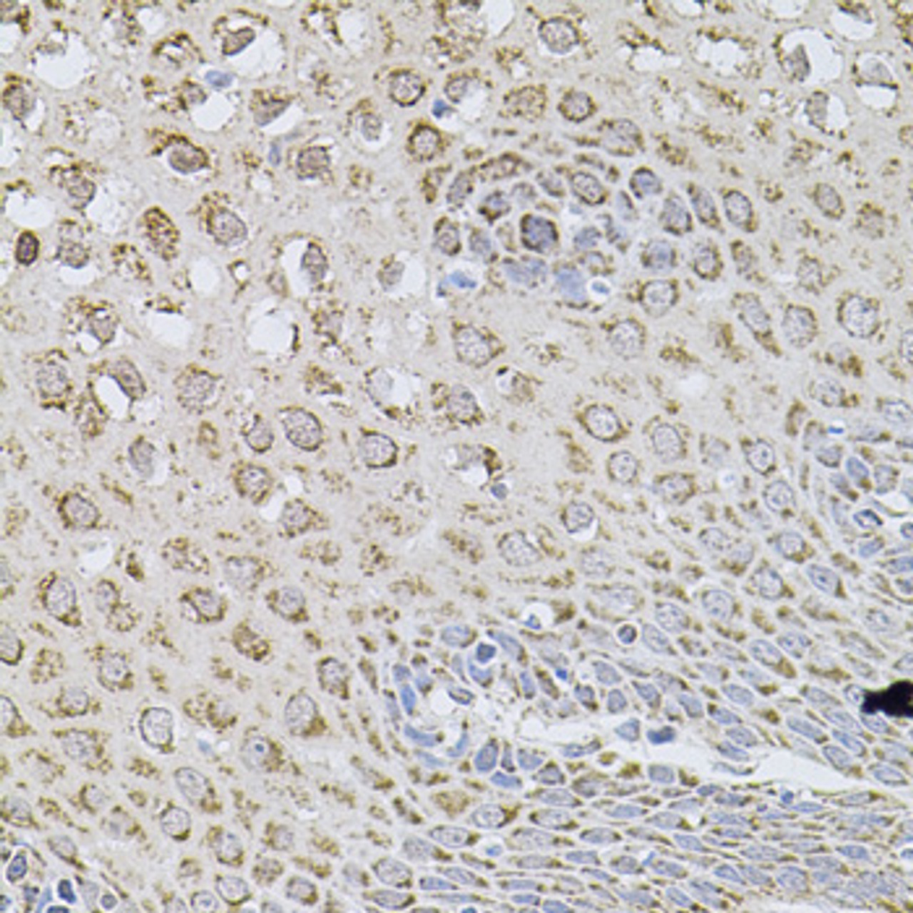 Immunohistochemistry of paraffin-embedded human esophagus using WISP2 antibody (14-494) at dilution of 1:100 (40x lens) .