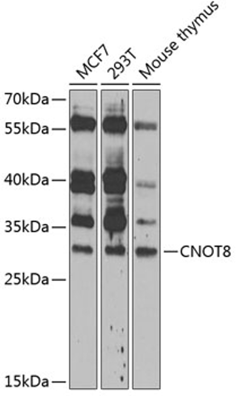 Western blot analysis of extracts of various cell lines, using CNOT8 antibody (14-500) at 1:1000 dilution.<br/>Secondary antibody: HRP Goat Anti-Rabbit IgG (H+L) at 1:10000 dilution.<br/>Lysates/proteins: 25ug per lane.<br/>Blocking buffer: 3% nonfat dry milk in TBST.<br/>Detection: ECL Enhanced Kit.<br/>Exposure time: 60s.