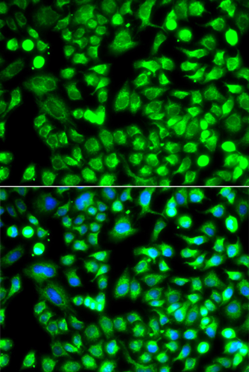 Immunofluorescence analysis of A549 cells using ALKBH4 antibody (14-530) . Blue: DAPI for nuclear staining.