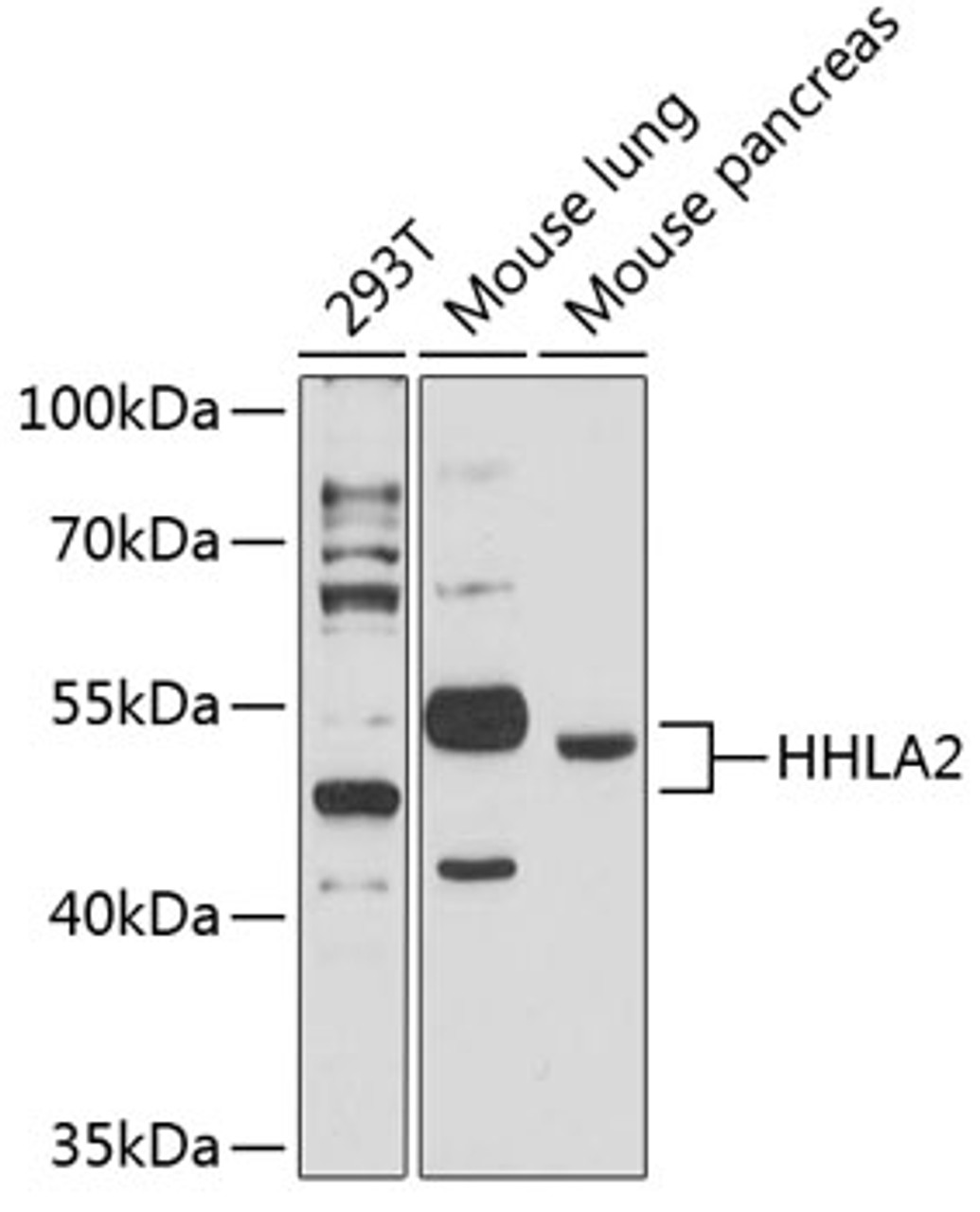 Western blot analysis of extracts of various cell lines, using HHLA2 antibody (14-877) at 1:3000 dilution.<br/>Secondary antibody: HRP Goat Anti-Rabbit IgG (H+L) at 1:10000 dilution.<br/>Lysates/proteins: 25ug per lane.<br/>Blocking buffer: 3% nonfat dry milk in TBST.<br/>Detection: ECL Basic Kit.<br/>Exposure time: 30s.