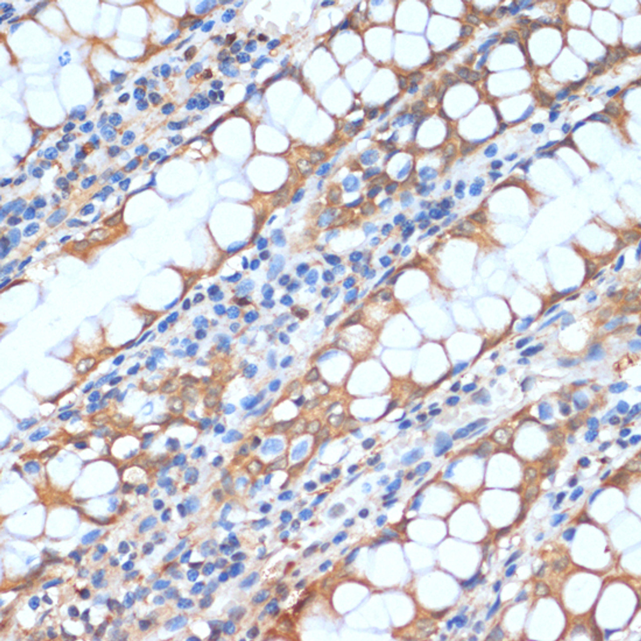 Immunohistochemistry of paraffin-embedded human colon using HHLA2 antibody (14-877) at dilution of 1:100 (40x lens) .