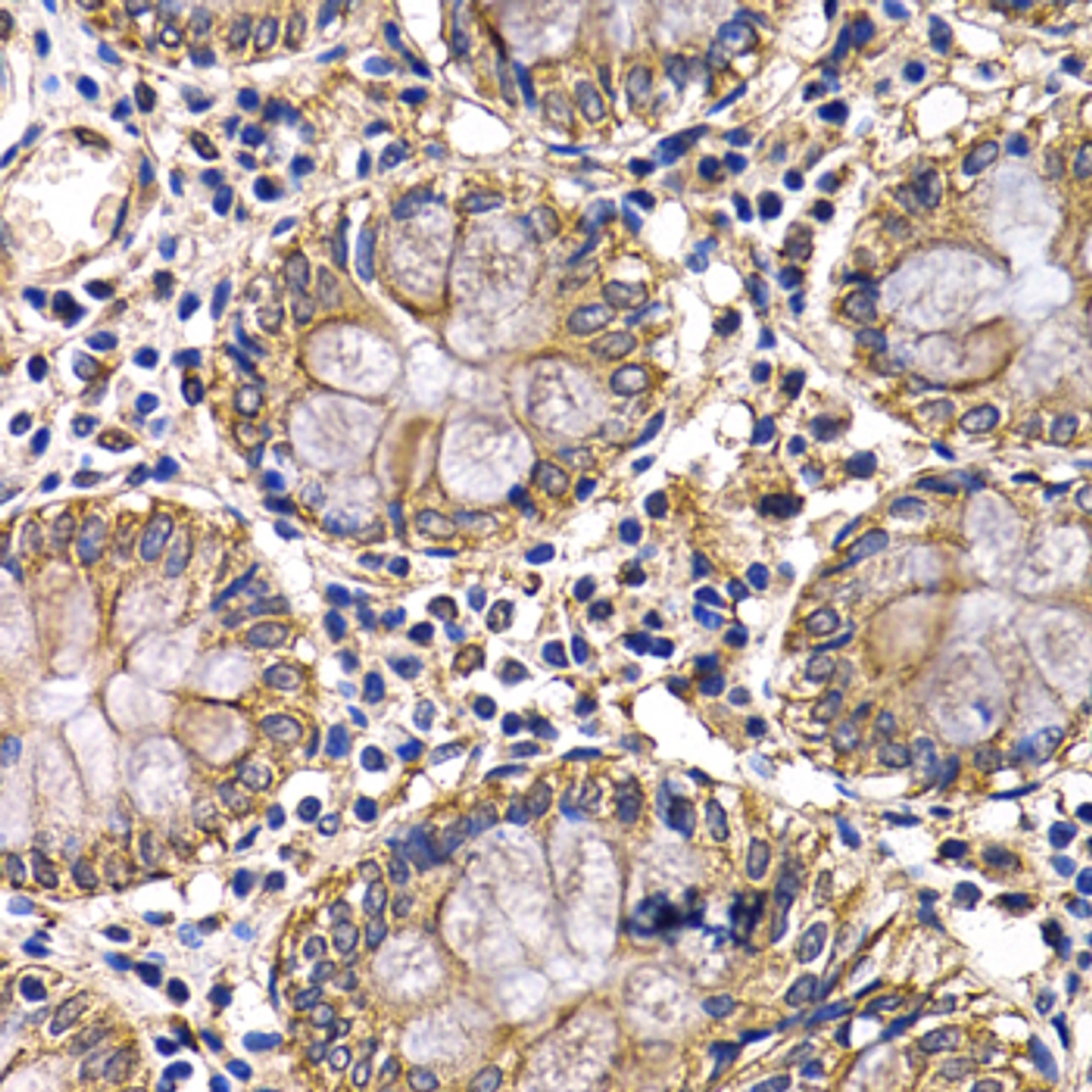 Immunohistochemistry of paraffin-embedded human colon using ARRB2 antibody (14-883) at dilution of 1:200 (40x lens) .