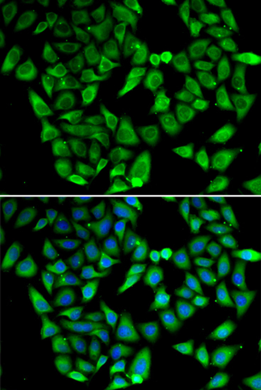 Immunofluorescence analysis of HeLa cells using ASIP antibody (14-885) . Blue: DAPI for nuclear staining.