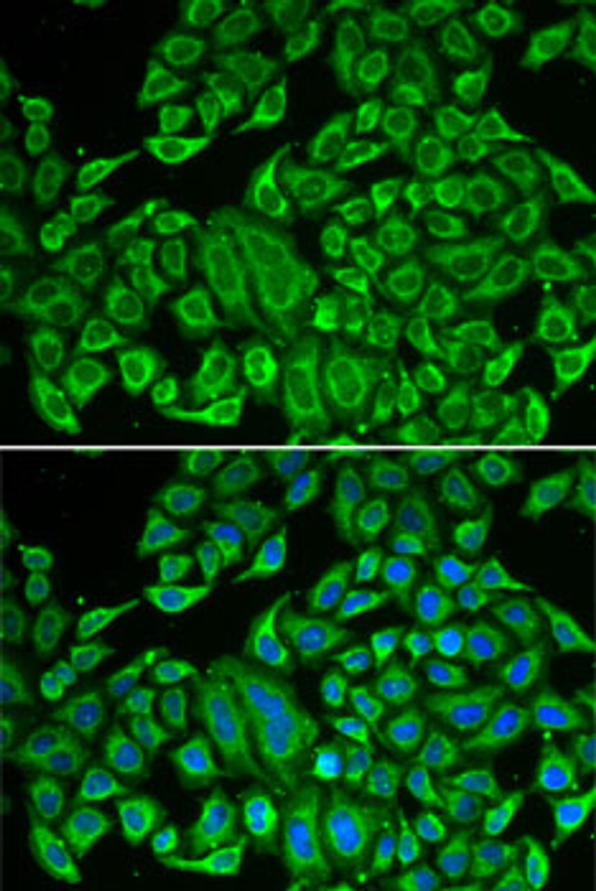 Immunofluorescence analysis of MCF7 cells using IL12RB1 antibody (14-916) . Blue: DAPI for nuclear staining.