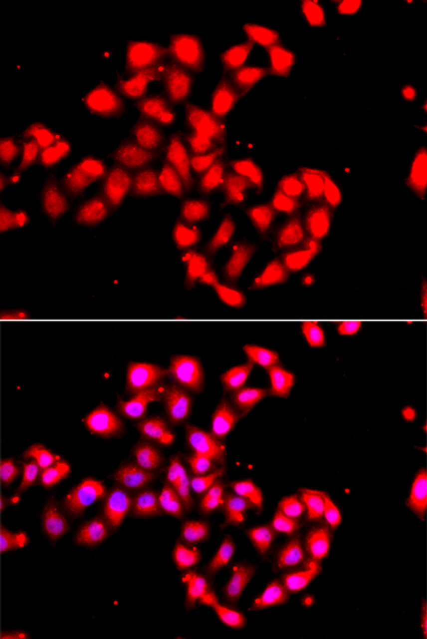 Immunofluorescence analysis of A549 cells using CAMK1D antibody (14-989) . Blue: DAPI for nuclear staining.