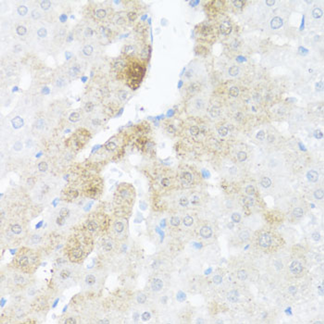 Immunohistochemistry of paraffin-embedded rat liver using BCL2L2 antibody (15-008) at dilution of 1:100 (40x lens) .
