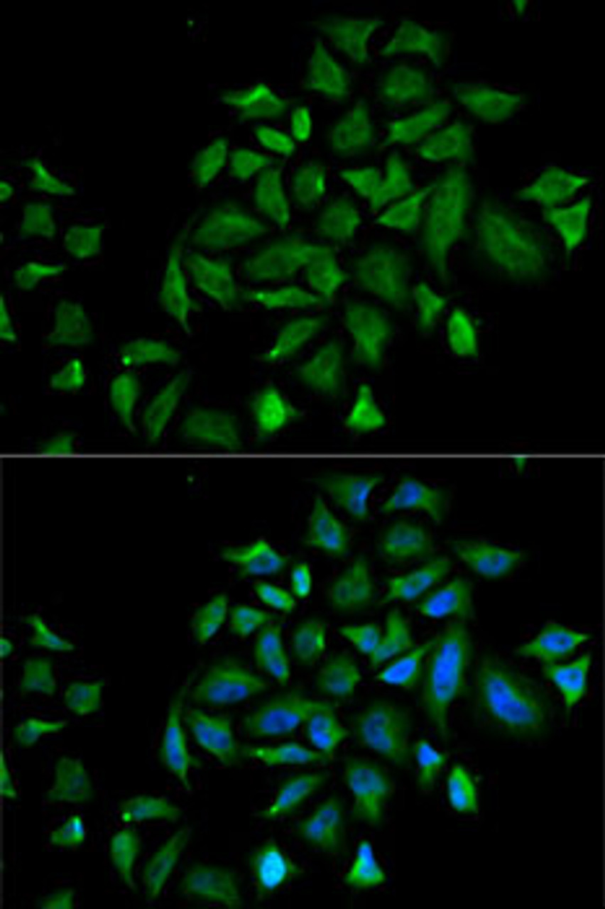 Immunofluorescence analysis of HeLa cells using FGFR1 antibody (15-021) . Blue: DAPI for nuclear staining.
