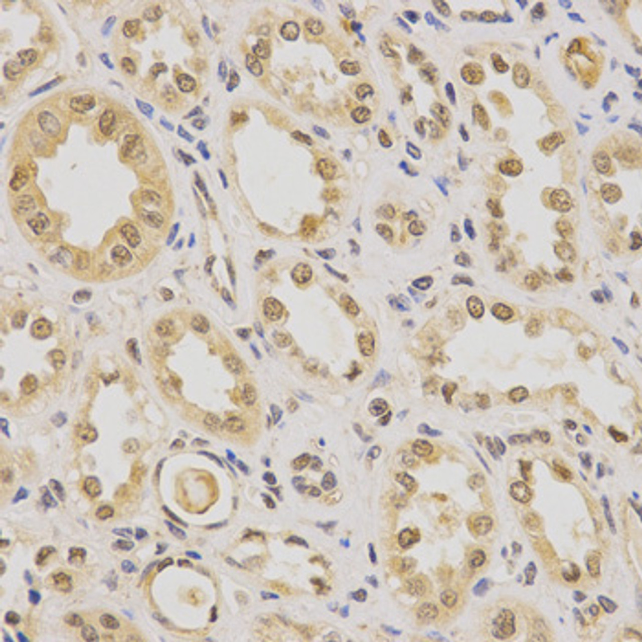 Immunohistochemistry of paraffin-embedded human kidney using PDHA1 Antibody (15-043) at dilution of 1:200 (40x lens) .